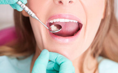 Les Meilleures Pratiques SEO pour Optimiser le Contenu des Sites Web des Dentistes à Lyon par l’Agence SEO Dentiste Lyon