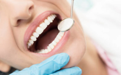 Évaluer la Concurrence en Ligne des Dentistes à Lyon : Les Critères Clés utilises par l’Agence SEO Dentiste Lyon