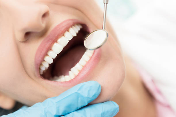 Évaluer la Concurrence en Ligne des Dentistes à Lyon : Les Critères Clés utilises par l’Agence SEO Dentiste Lyon